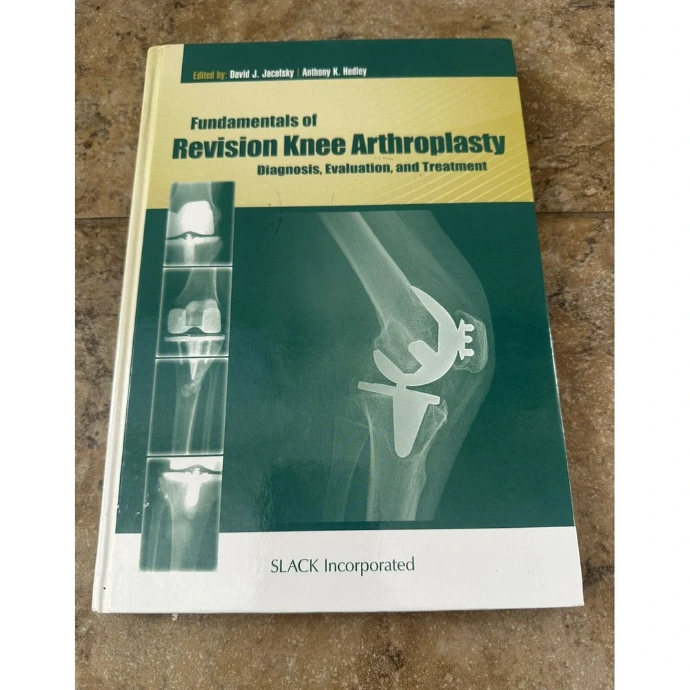 Fundamentals of Revision Knee Arthroplasty : Diagnosis, Evaluation, and Treat...